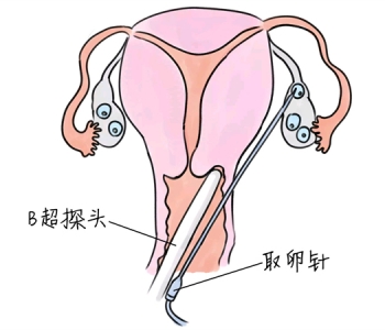 幼儿学画画，上海捐卵宝宝学画画，学画画的好处，如何学画画